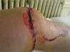 post-114-128790027729_thumb.jpg