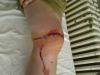 post-114-12879002773418_thumb.jpg